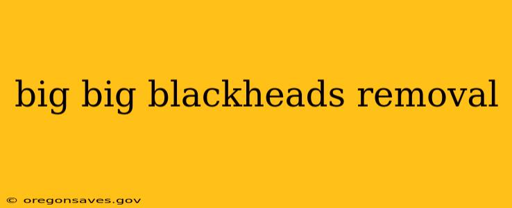 big big blackheads removal