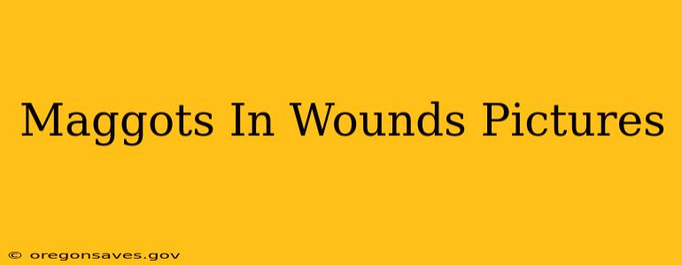 Maggots In Wounds Pictures