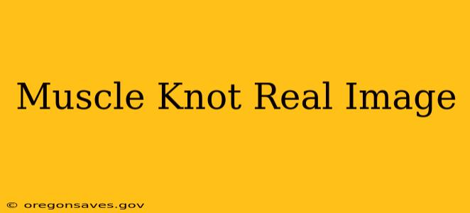 Muscle Knot Real Image