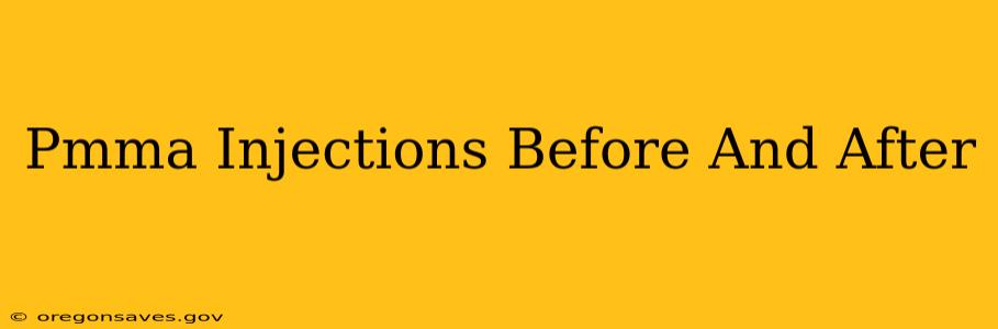 Pmma Injections Before And After