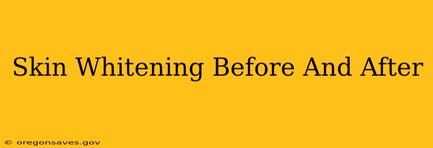 Skin Whitening Before And After