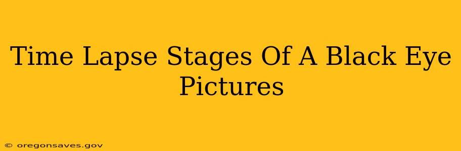 Time Lapse Stages Of A Black Eye Pictures